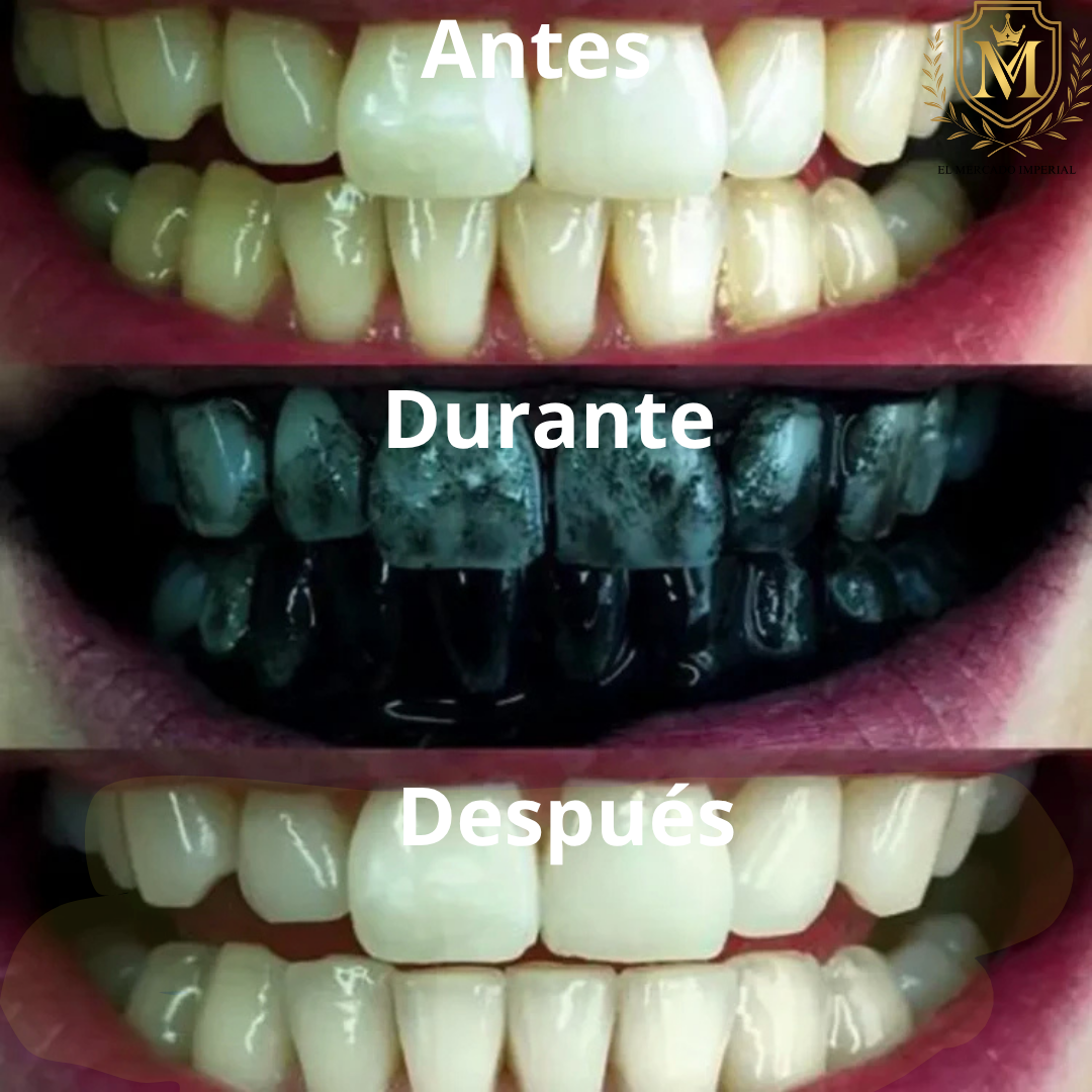 Blanqueador Dental Miracle Teeth – Elimina manchas / Lleva 2 y paga 1